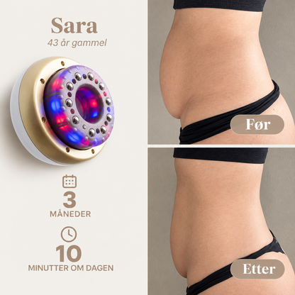Cellulitemassasje
